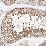 Merck Anti-DIRAS3 antibody produced in rabbit