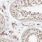 Merck Anti-GPATCH2 antibody produced in rabbit