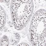 Merck Anti-SF3B4 antibody produced in rabbit