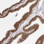 Merck Anti-WDR77 antibody produced in rabbit