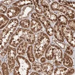 Merck Anti-CCDC190 antibody produced in rabbit
