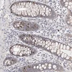 Merck Anti-CCDC190 antibody produced in rabbit