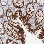 Merck Anti-CCDC28B antibody produced in rabbit
