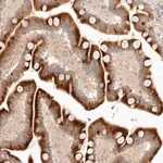 Merck Anti-UBXN11 antibody produced in rabbit