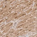 Merck Anti-TARS2 antibody produced in rabbit