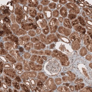 Merck Anti-RAB11FIP3 antibody produced in rabbit