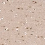 Merck Anti-AHDC1 antibody produced in rabbit