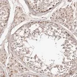 Merck Anti-WRN antibody produced in rabbit