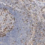 Merck Anti-PHACTR2 antibody produced in rabbit