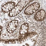 Merck Anti-AURKAIP1 antibody produced in rabbit
