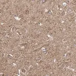 Merck Anti-NALCN antibody produced in rabbit