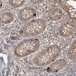 Merck Anti-CACNA2D4 antibody produced in rabbit