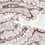 Merck Anti-PLEKHG1 antibody produced in rabbit