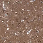 Merck Anti-GAK antibody produced in rabbit