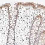 Merck Anti-MED18 antibody produced in rabbit