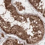 Merck Anti-STK36 antibody produced in rabbit