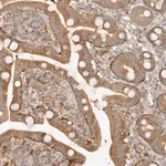 Merck Anti-HECTD3 antibody produced in rabbit