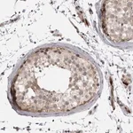 Merck Anti-EPHA10 antibody produced in rabbit