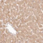 Merck Anti-PPP1R3B antibody produced in rabbit