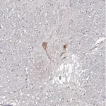 Merck Anti-GNRH1 antibody produced in rabbit