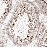 Merck Anti-LCORL antibody produced in rabbit