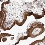 Merck Anti-RRM2B antibody produced in rabbit