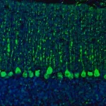 Merck Anti-C21orf59 antibody produced in rabbit