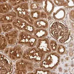 Merck Anti-FREM2 antibody produced in rabbit