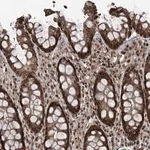 Merck Anti-ZNF570 antibody produced in rabbit