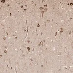 Merck Anti-UBE2K antibody produced in rabbit