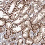 Merck Anti-AKAP10 antibody produced in rabbit