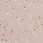 Merck Anti-HDAC9 antibody produced in rabbit