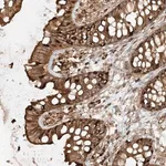 Merck Anti-CCDC115 antibody produced in rabbit