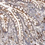 Merck Anti-ATXN3L antibody produced in rabbit