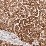Merck Anti-IL1R2 antibody produced in rabbit