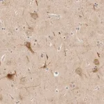 Merck Anti-PCDH19 antibody produced in rabbit