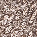 Merck Anti-ADAMTS20 antibody produced in rabbit