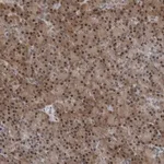 Merck Anti-AKR1A1 antibody produced in rabbit