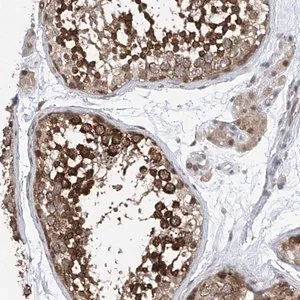 Merck Anti-CETN1 antibody produced in rabbit