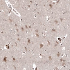 Merck Anti-USP43 antibody produced in rabbit