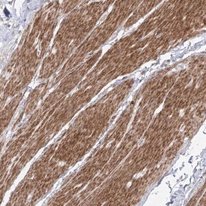 Merck Anti-ZNF180 antibody produced in rabbit
