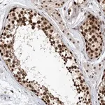 Merck Anti-ZNF470 antibody produced in rabbit