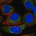 Merck Anti-KHDC1 antibody produced in rabbit