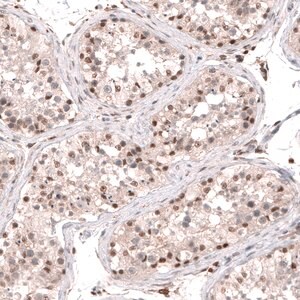 Merck Anti-SMYD2 antibody produced in rabbit