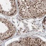 Merck Anti-TRAPPC12 antibody produced in rabbit