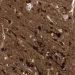 Merck Anti-HS6ST2 antibody produced in rabbit