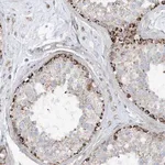Merck Anti-PHOSPHO2 antibody produced in rabbit