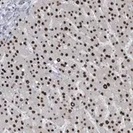 Merck Anti-TFPT antibody produced in rabbit