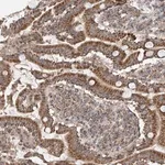Merck Anti-UQCC1 antibody produced in rabbit