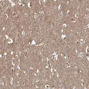 Merck Anti-EPHX4 antibody produced in rabbit